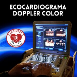 Ecocardiograma Doppler Color