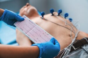 Electrocardiograma de 12 derivaciones ECG