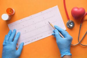 Electrocardiograma ECG